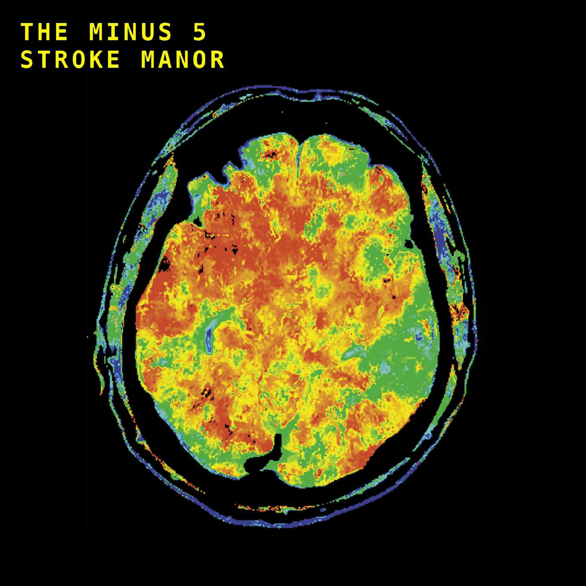 The Minus 5 - Stroke Manor - Vinyl